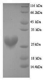 Mouse Nqo2 protein