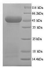Human WNT10A protein