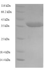 Human CASP5 protein