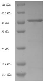 Human TNFRSF21 protein