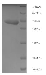 E.coli PD-L1 protein