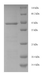 E.coli Ribosome-inactivating protein