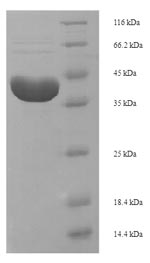 E.coli alpha-trichosanthin protein