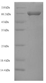 Human VIPAS39 protein