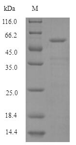 Human HARS protein
