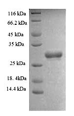 Human SMARCC1 protein