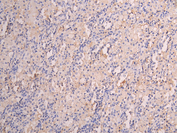 FCGRT Antibody