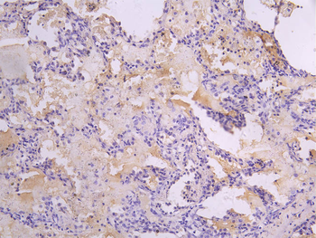 FGFR2 Antibody