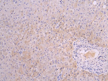 FGFR2 Antibody