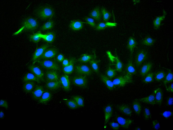 ILDR2 Antibody