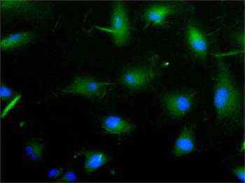 ILDR2 Antibody