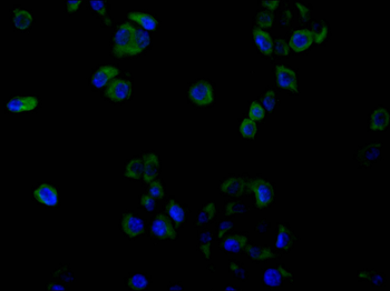 GLP1R Antibody