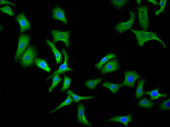 APP Antibody