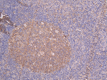 TUBB Antibody