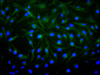 FGF1 Antibody