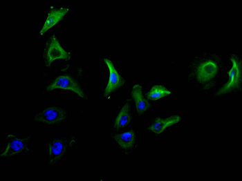 LY6E Antibody