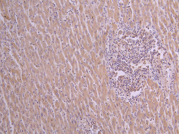 VEGFA Antibody