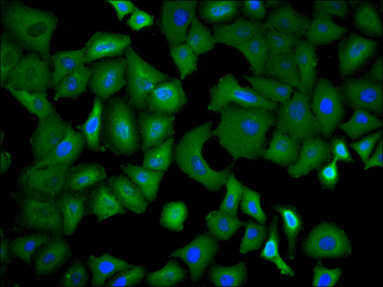 VEGFA Antibody