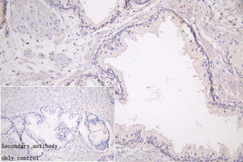 LRP1 Antibody