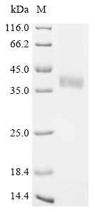 Recombinant Human Deoxyribonuclease-1 (DNASE1)