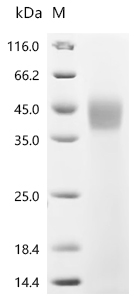 Recombinant Macrovipera lebetina Chymotrypsin-like protease VLCTLP
