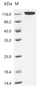 Recombinant Human Vascular endothelial growth factor receptor 2 (KDR), partial