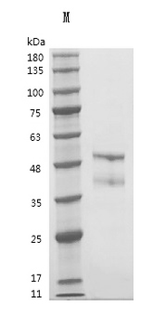 Recombinant Human Interleukin-21 (IL21) (Active)