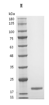 Recombinant Human Interleukin-21 (IL21) (Active)