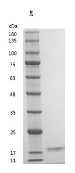 Recombinant Human Interleukin-2 (IL2) (Active)