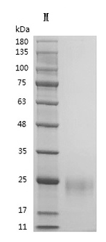 Recombinant Human Vascular endothelial growth factor A, long form (VEGFA) (Active)
