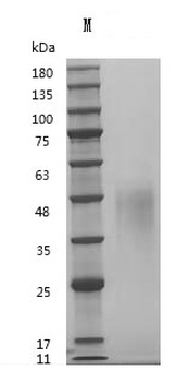 Recombinant Human Leukemia inhibitory factor (LIF) (Active)