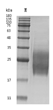 Recombinant Human Granulocyte-macrophage colony-stimulating factor (CSF2) (Active)