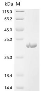 Recombinant Newcastle disease virus RNA-directed RNA polymerase L (L), partial