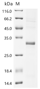 Recombinant Human Ryanodine receptor 3 (RYR3), partial