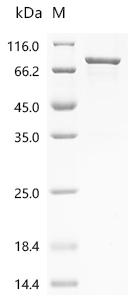 Recombinant Human Serine/threonine-protein phosphatase 2A regulatory subunit B'' subunit beta (PPP2R3B)