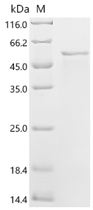 Recombinant Newcastle disease virus Fusion glycoprotein F0 (F), partial
