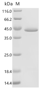 Recombinant Human L-lactate dehydrogenase B chain (LDHB)