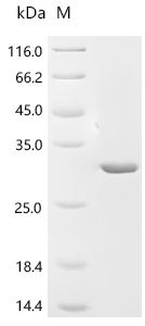 Recombinant Newcastle disease virus RNA-directed RNA polymerase L (L), partial