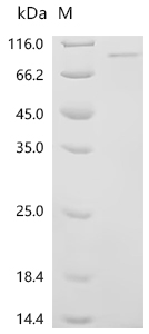 Recombinant Mouse Receptor-interacting serine/threonine-protein kinase 1 (Ripk1)