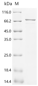 Recombinant Human Lysosomal acid glucosylceramidase (GBA1)