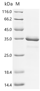 Recombinant Streptococcus sp. group G Immunoglobulin G-binding protein G (spg), partial