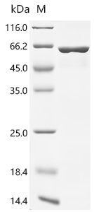 Recombinant Human Vimentin (VIM)