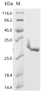 Recombinant Human Focadhesin (FOCAD), partial