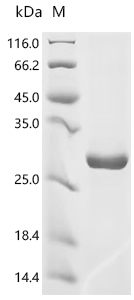 Recombinant Human Focadhesin (FOCAD), partial