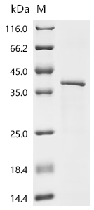 Recombinant Drosophila melanogaster Tyrosine-protein kinase hopscotch (hop), partial