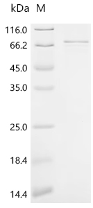 Recombinant Human Polypeptide N-acetylgalactosaminyltransferase 14 (GALNT14)