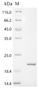Recombinant Macaca fascicularis Parathyroid hormone (PTH)