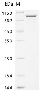 Recombinant Human Heterogeneous nuclear ribonucleoprotein K (HNRNPK), partial