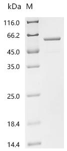 Recombinant Human ATP synthase subunit beta, mitochondrial (ATP5F1B)