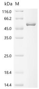 Recombinant Human Cartilage-associated protein (CRTAP)